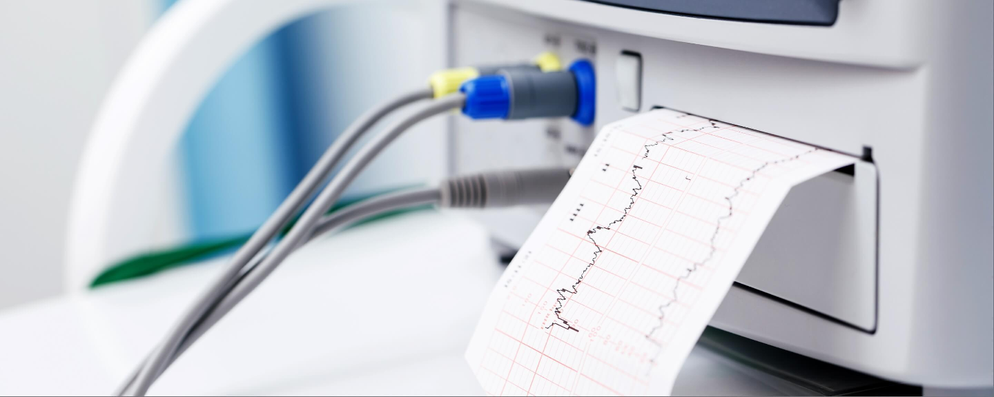 Case study avoidable hypoxia results in stillbirth