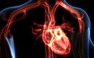 Aortic Aneurysm