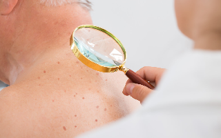 Melanoma Misdiagnosis