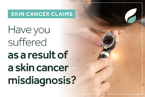 Skin cancer claims information video by Gadsby Wicks