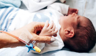Input birth injury