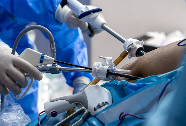Bile Duct Injuries 1248x844