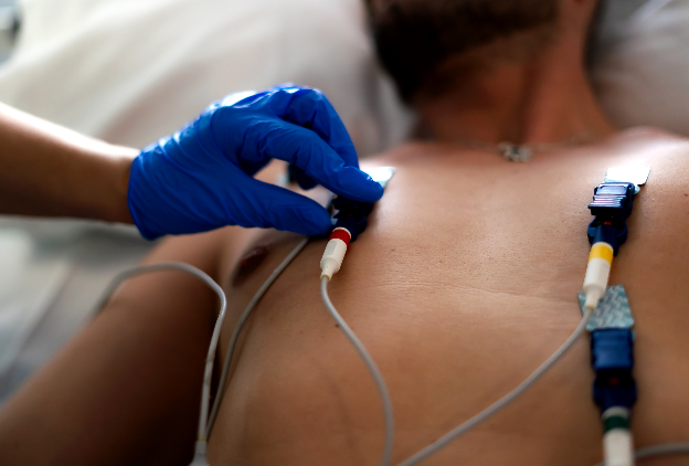 Atrial fibrillation misdiagnosis 1248x844