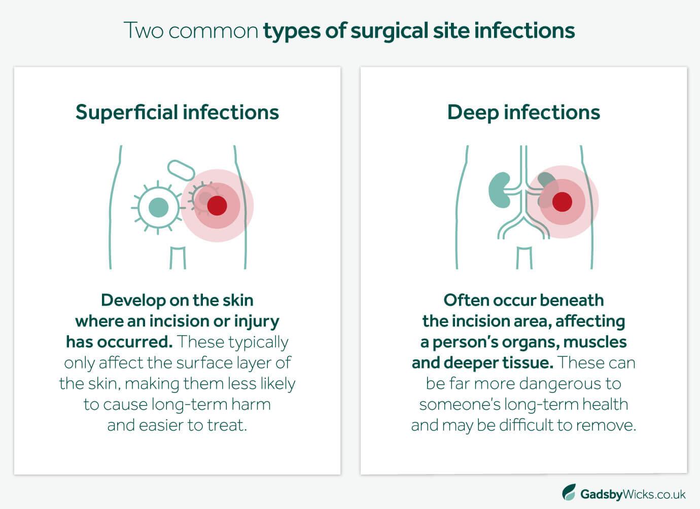 Common types of surgical infections shown for medical negligence cases - Infographic image