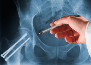 Trusted experienced solicitors for orthopaedic surgery claims cases