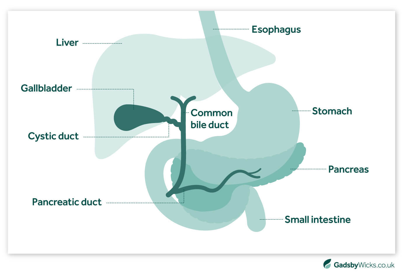 Gadsby Wicks infographic showing the anatomy of the biliary system, where bile duct injuries may occur during abdominal surgery