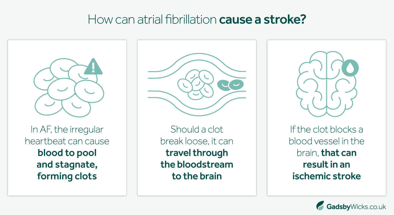 Gadsby Wicks infographic showing how atrial fibrillation makes a stroke more likely, which makes a atrial fibrillation misdiagnosis especially dangerous